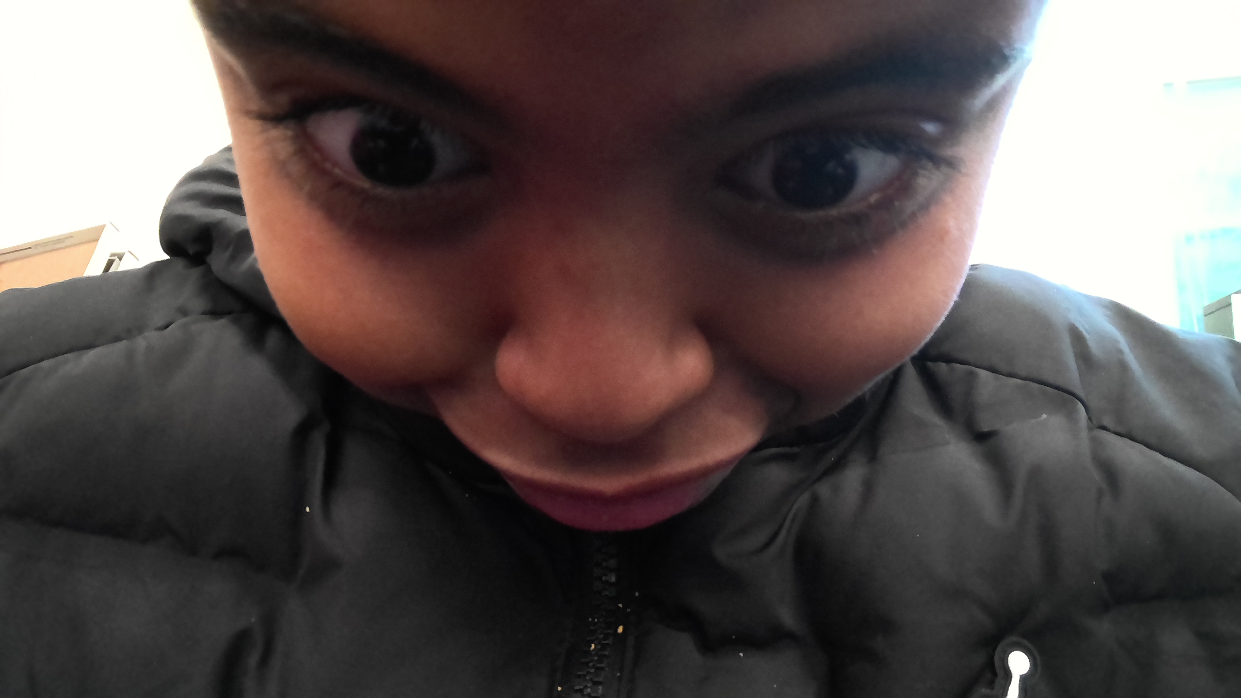 me have big forehead
