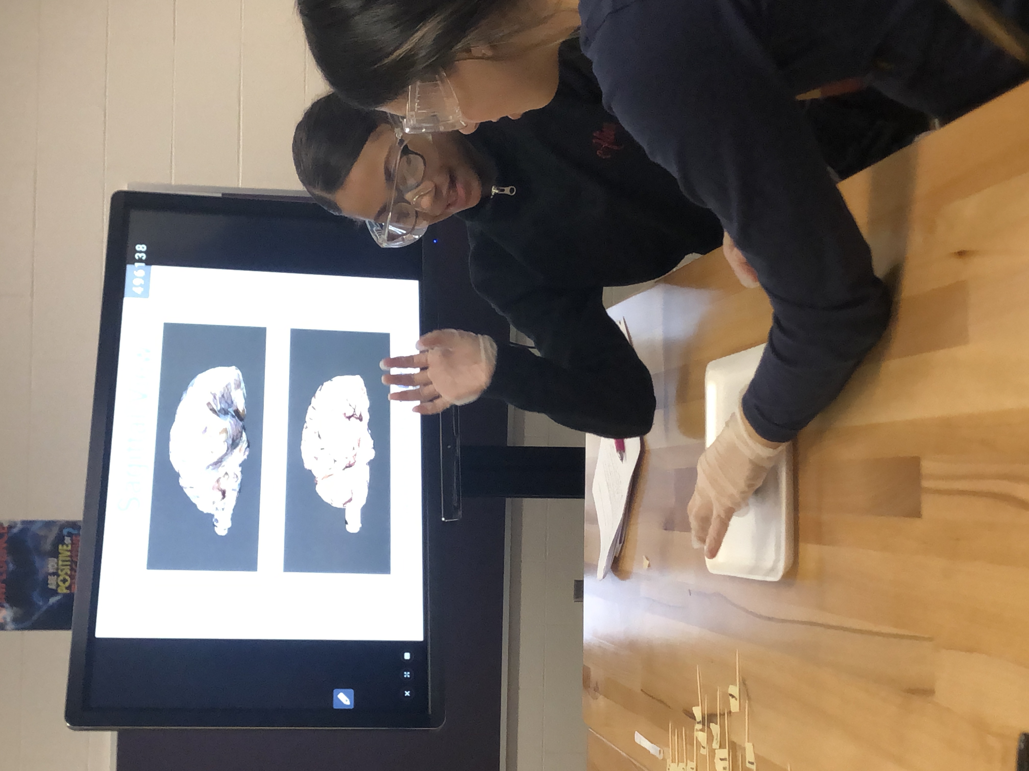 brain disection